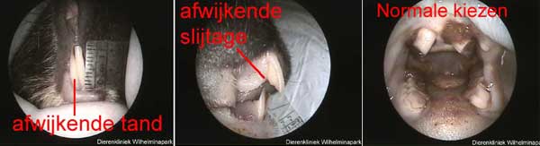 Aan de tanden zijn afwijkingen gezien, de kiezen zijn normaal