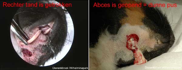 De tand is getrokken en het abces is geopend
