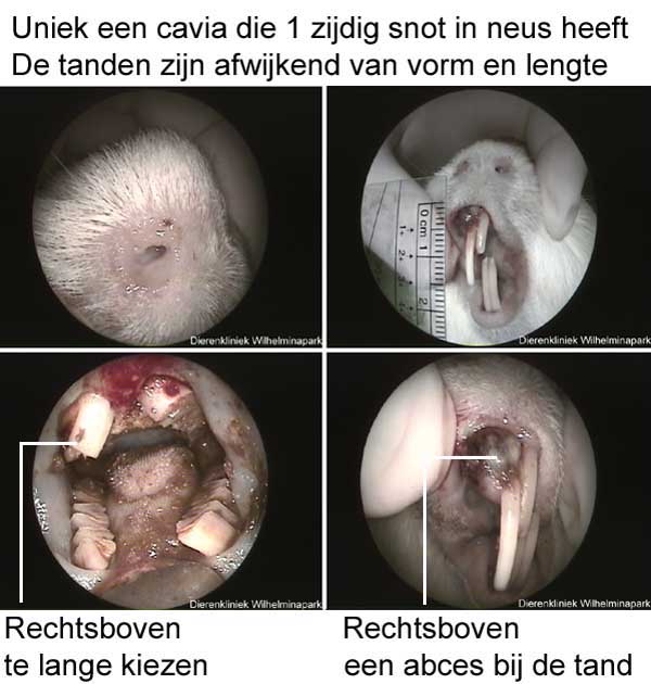 Abces door een afgebroken tand die een snotneus veroorzaakte