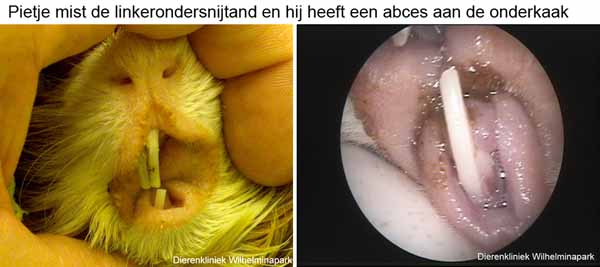 De linkerondertand is afgebroken