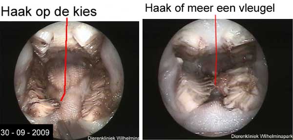 Haken op de kiezen steken niet in de tong, maar vormen een brug over de tong