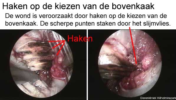 Haken op de bovenkaak kiezen kunnen wangslijmvlies beschadiging en daardoor abcessen veroorzaken