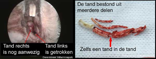 De getrokken tand was erg afwijkend