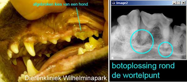 Een voorbeeld van een afgebroken kies bij eenhnd. Op de rontgenfoto is een wortelpuntabces te zien aan de botoplossing