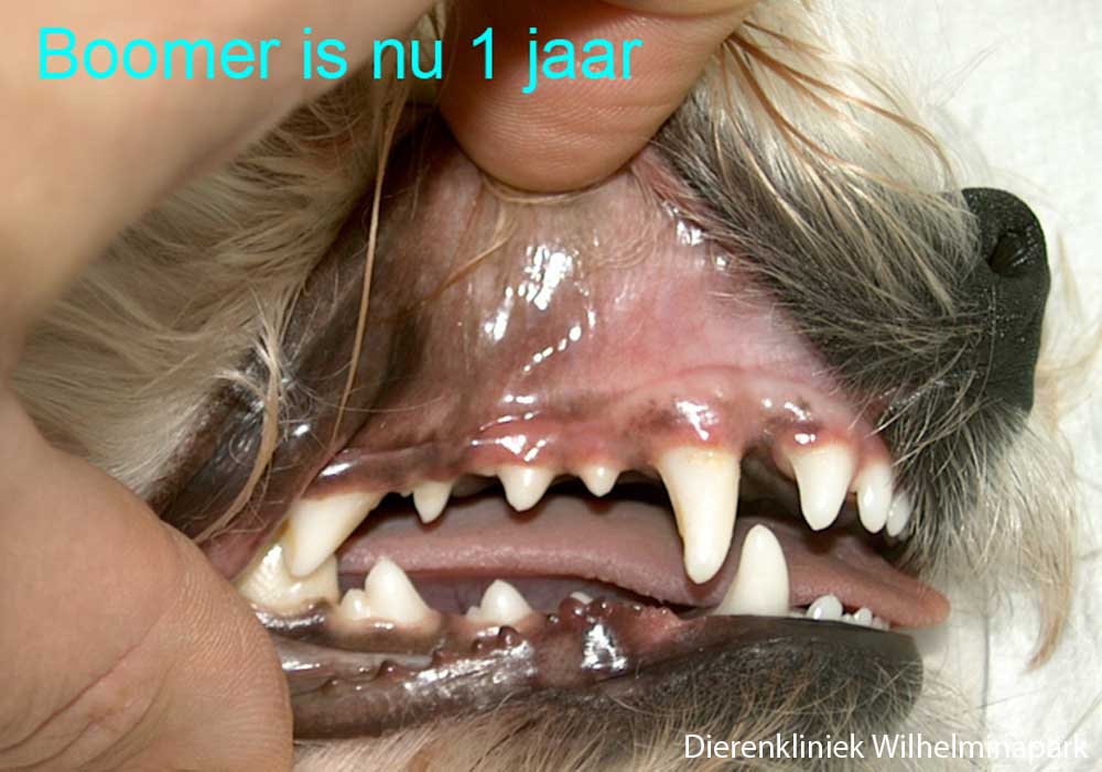 Bij deze patient is er gelukkig geen afwijking aan de blijvende haaktand op latere leeftijd ontstaan.