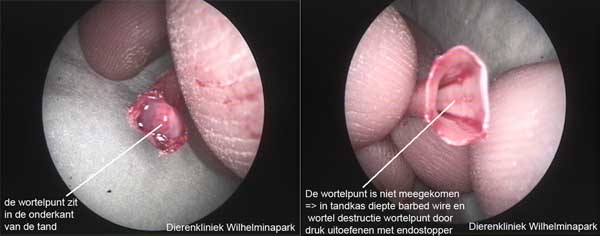 Nadat de tand getrokken is cotroleren we of de wortel in de tand zit.