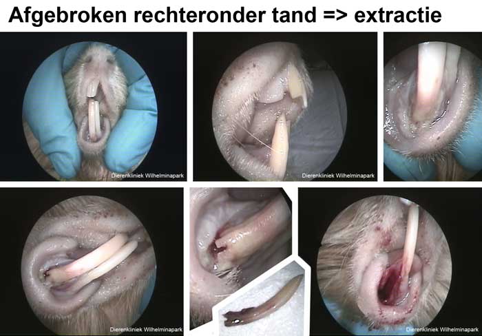 Afgebroken tand rechtsonder deze wordt getrokken
