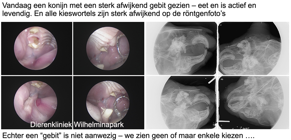 Geen kiezen aanwezig door ADD of tandresorptie